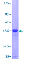 12.5% SDS-PAGE Stained with Coomassie Blue.